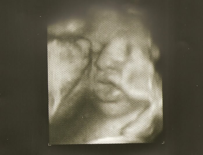 Sugar and Spice- Our Journey to Parenthood: 37 week ultrasound pictures!